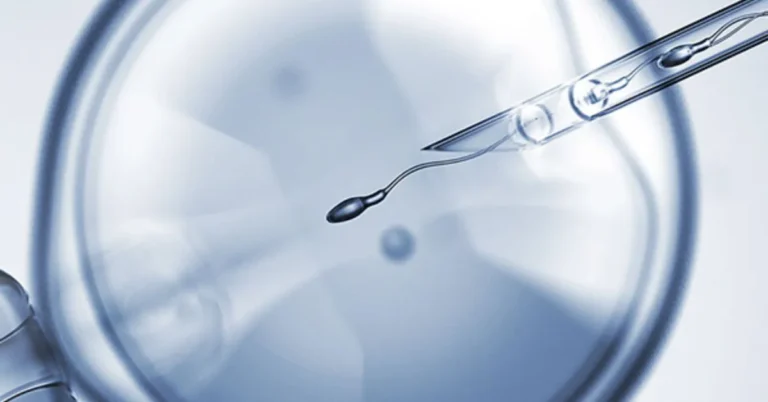 Fertility Treatment