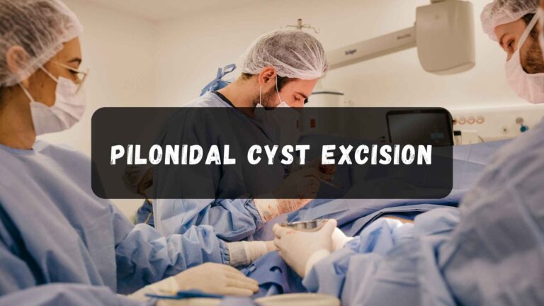 Pilonidal Cyst Excision
